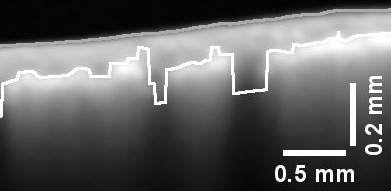 Membrane Wetting in situ Visualized by Means of Optical Coherence Tomography